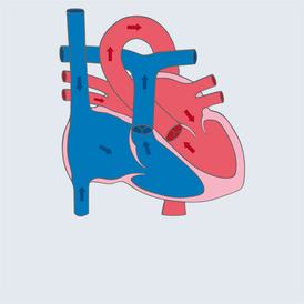 The human heart and possible defects
