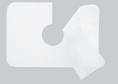 TiSURE® – Titanised mesh implant