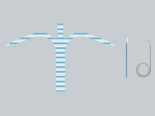 TiLOOP® PRO PLUS P