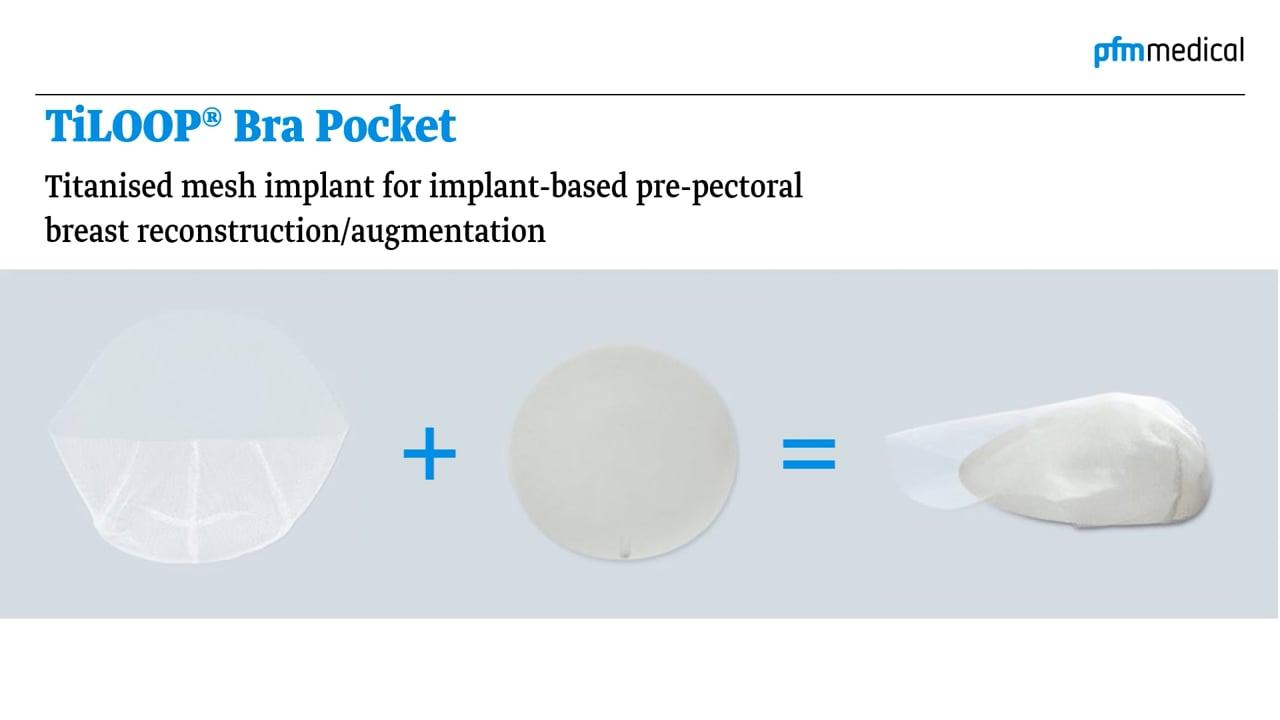 TiLOOP® Bra Pocket - mesh implant for implant-based, prepectoral breast reconstruction (Animation)