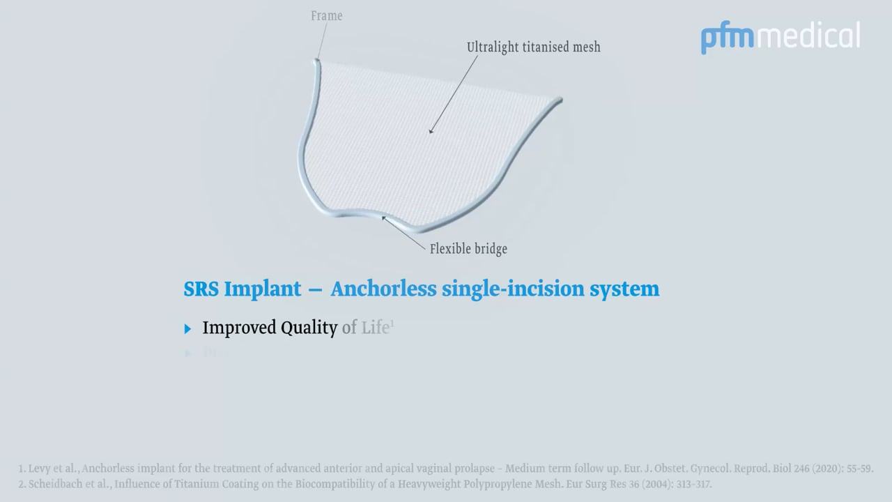 SRS Implantat (Self-Retaining Support) - Surgery Video with Interview