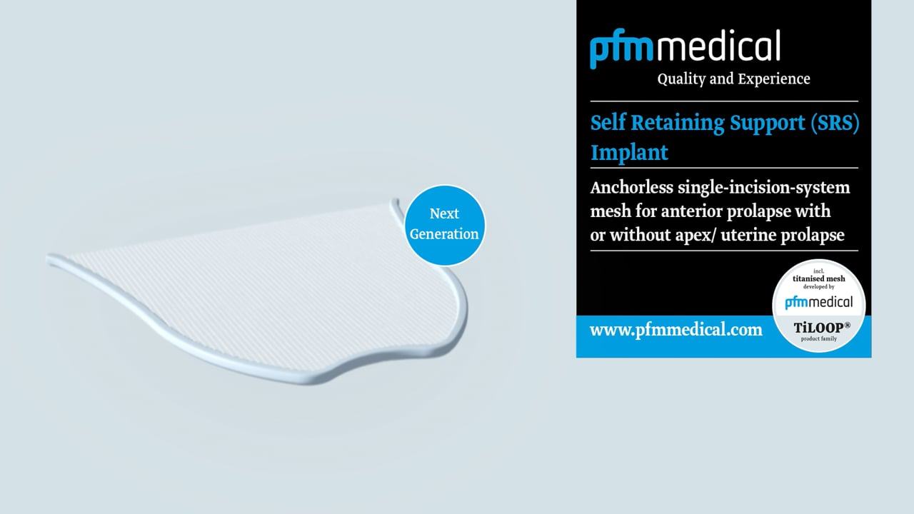 Animation: SRS-Implantat (EN)